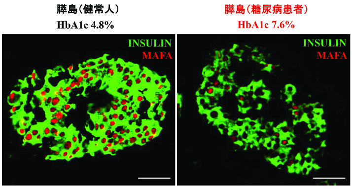 図1: 膵β細胞における転写因子の役割