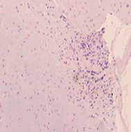 IVUS�|VH�@��������