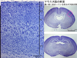 Cerebral cortex