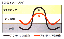 DBSイメージ図