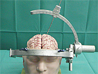 駒井式定位脳手術装置