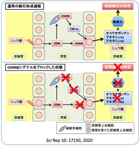 野生型マウスの尿路結石モデルマウスの腎において、OSMやOSMRβの発現増加が認められた。また、OSMRβ遺伝子欠損マウスを用いて上記の尿路結石モデルマウスを作成したところ、野生型マウスに比べて結晶形成量、および腎における炎症性サイトカイン（TNF-αやIL-1β）や結晶結合蛋白（オステオポンチンやアネキシンa1, a2）の発現量の減少が認められた。以上の結果より、OSMは、炎症性サイトカインや結晶結合蛋白の産生を誘導し、尿路結石形成を促進する可能性が示唆された。