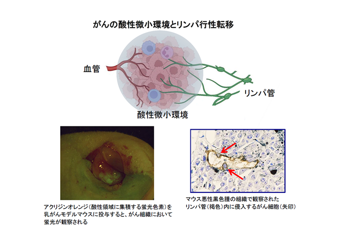 癌の酸性微小環境とリンパ行性転移図