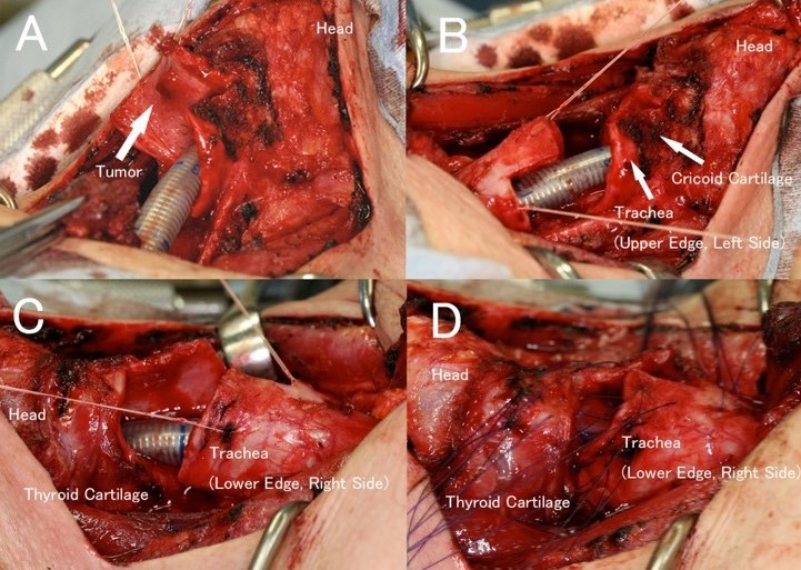 甲状腺外科写真