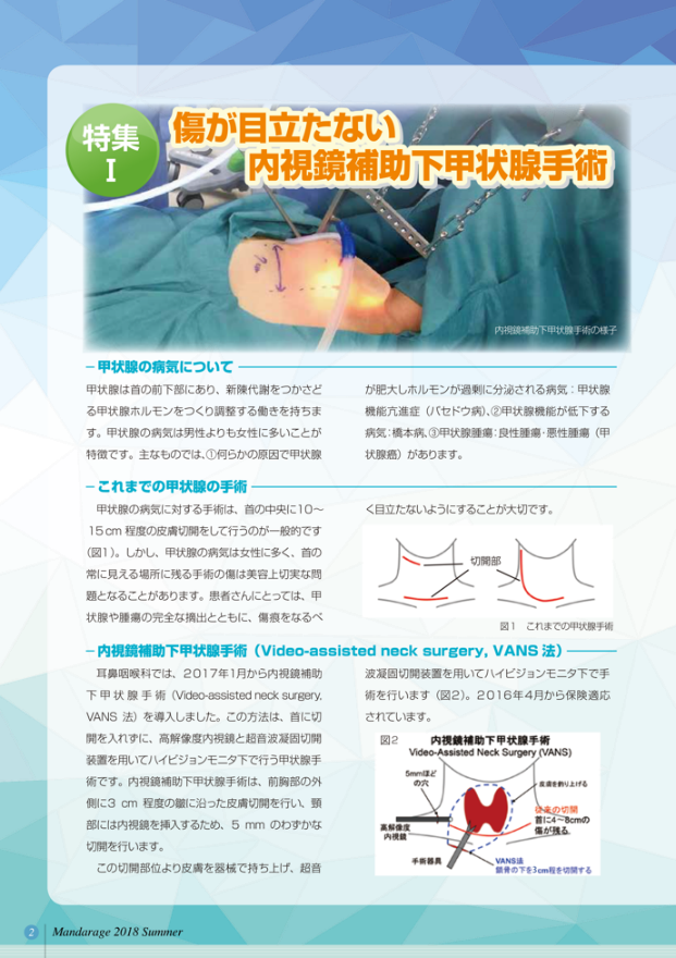 傷が目立たない内視鏡補助下甲状腺手術1