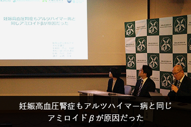リンクバナー 妊娠高血圧腎症もアルツハイマー病と同じ アミロイドβが原因だった