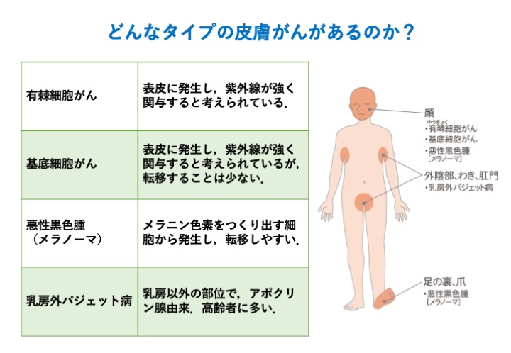 どんなタイプの皮膚がんがあるのか？