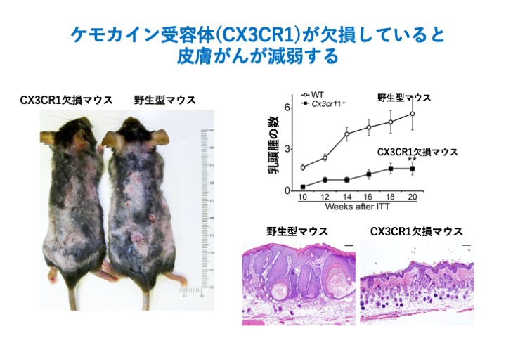 ケモカイン受容体(CX3CR1)が欠損していると皮膚がんが減弱する
