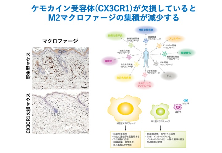 ケモカイン受容体(CX3CR1)が欠損しているとM2マクロファージの集積が減少する