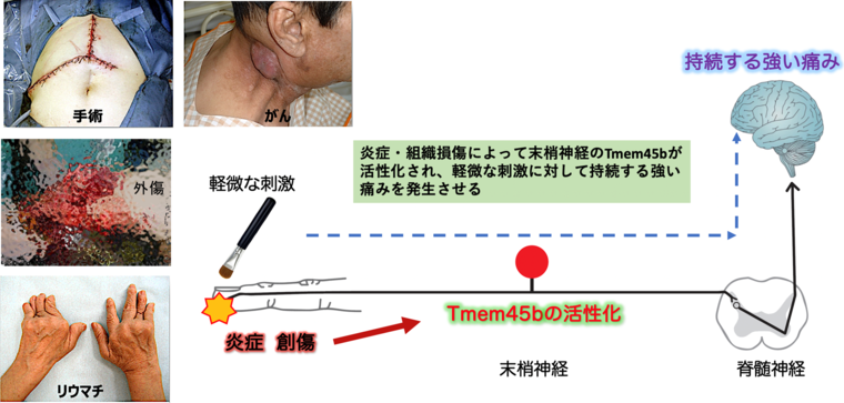 Tmem45bについて