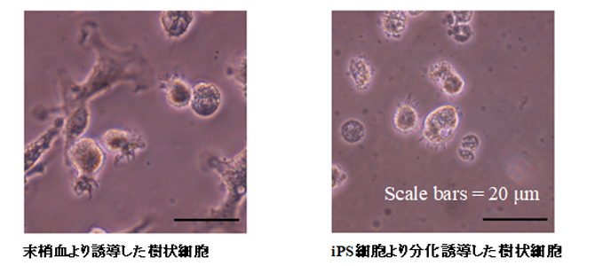 図1 大腸癌患者より分化誘導したヒトiPS-DC