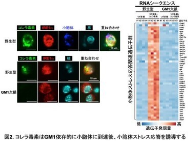 コレラ毒素はGM1依存的に小胞体に到着後、小胞体ストレス応答を誘導する