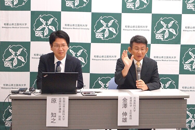 中條 ・ 西村症候群 (遺伝性難病)の遺伝子変化をもち 病態を再現する新規モデルマウスを樹立