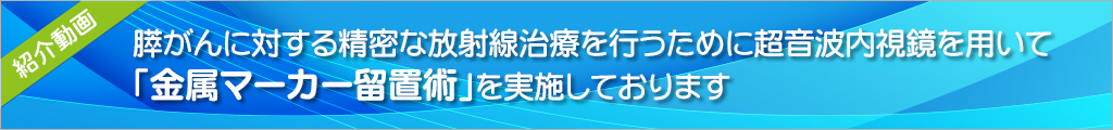 金属マーカー留置術を実施しております