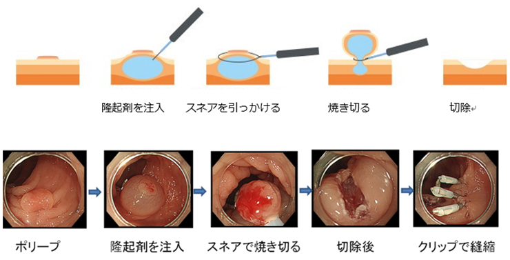 イメージ図