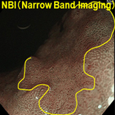 内視鏡画像