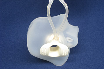 口腔内持続吸引装置つきマウスピース（Continuous Suction Mouthpiece; CSM）