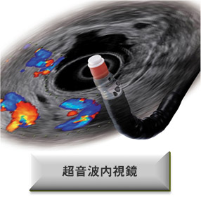 超音波内視鏡イメージ