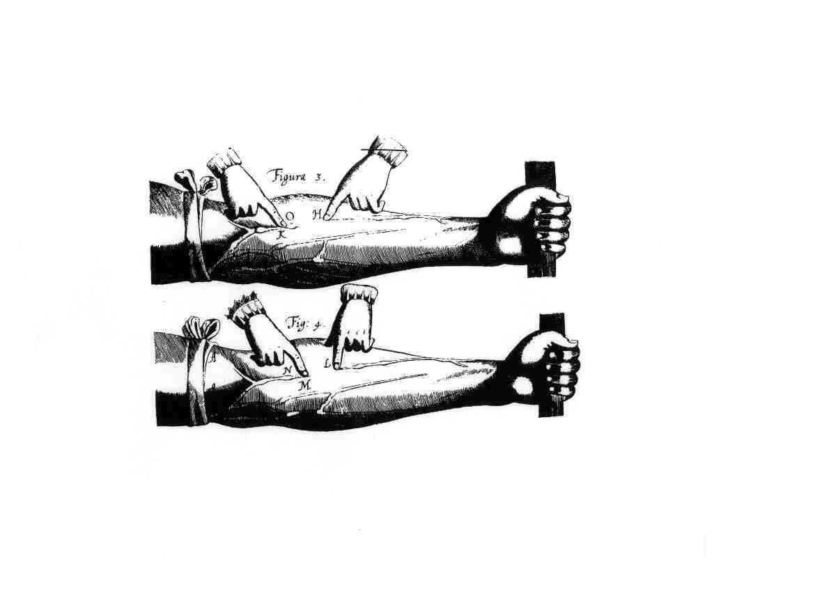 original picture of ligature, No.3&4