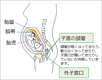 る 子宮 おり