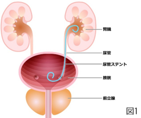 図1膀胱