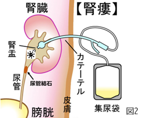 図2腎臓